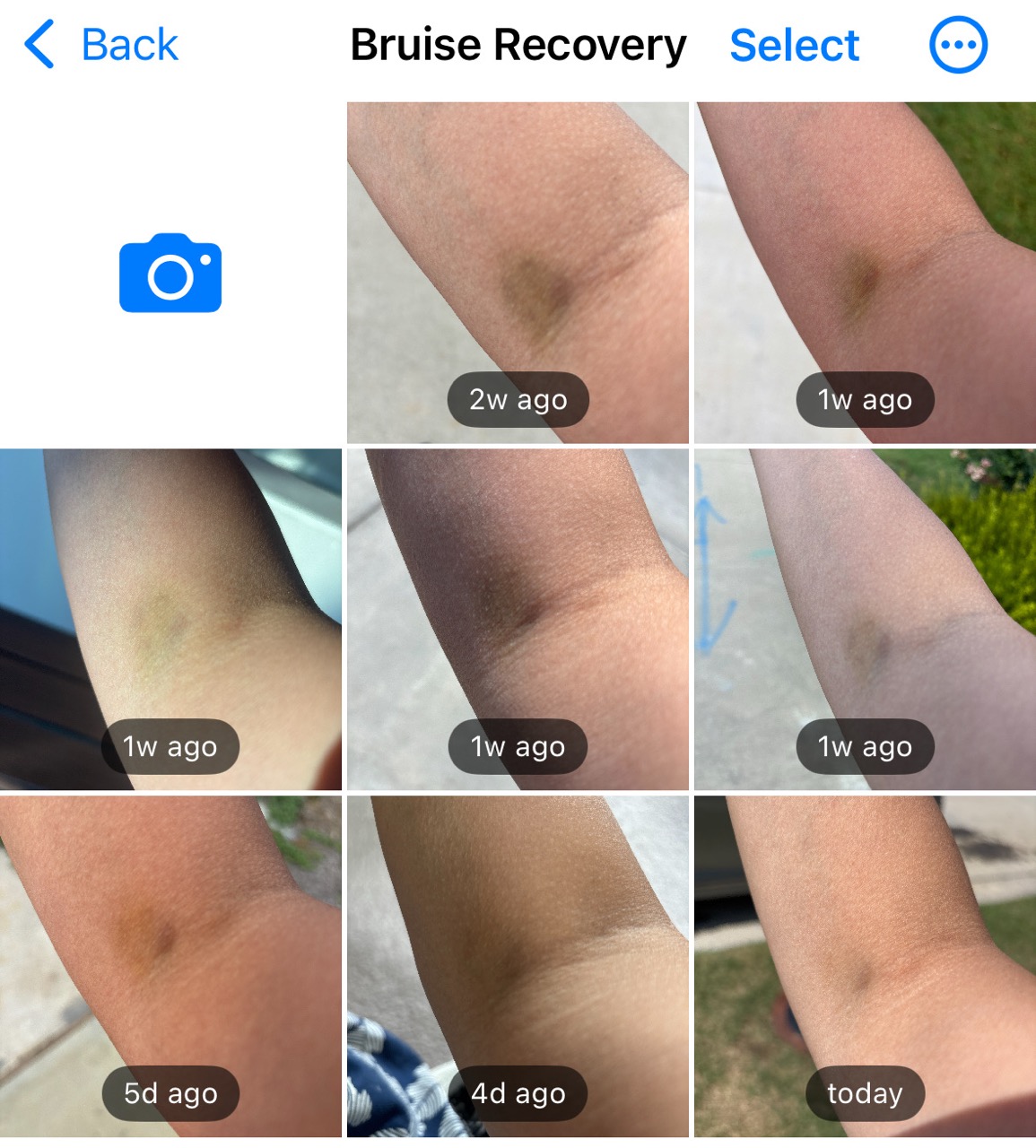 Arm Recovery